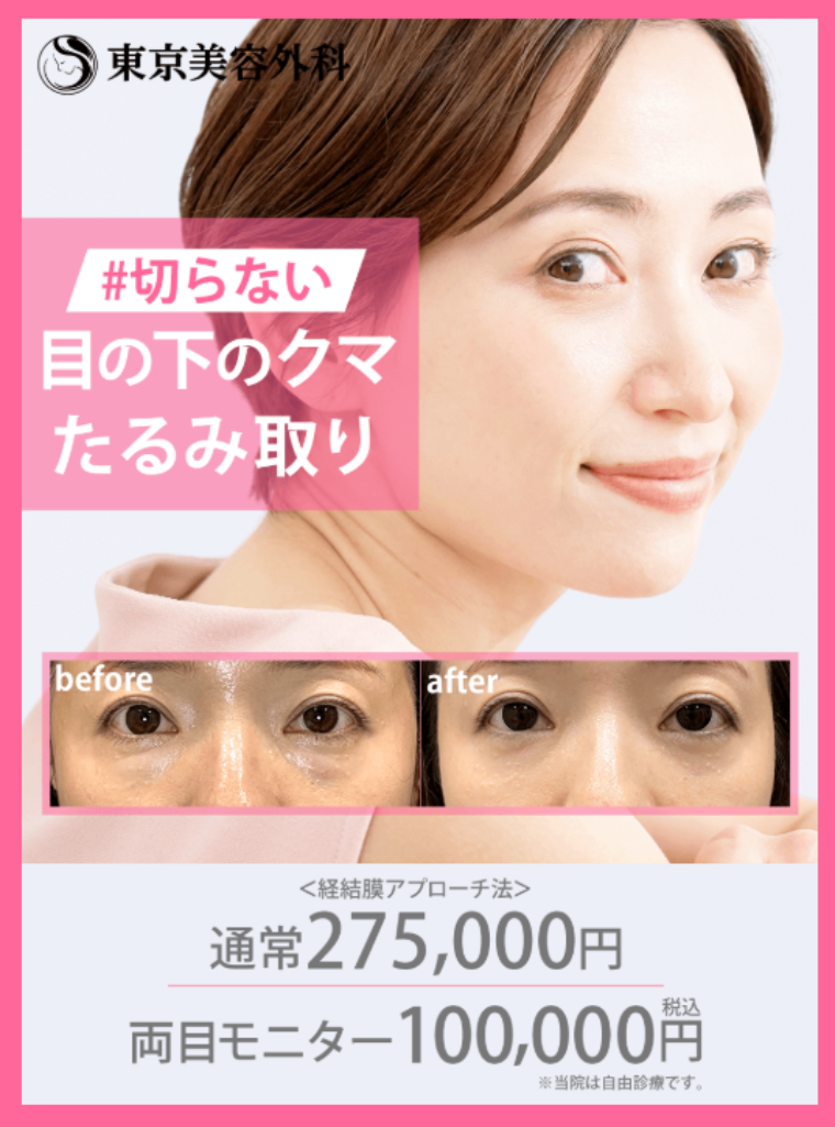 東京美容外科のクマ取り