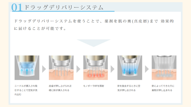 ポテンツァのドラッグデリバリーシステム