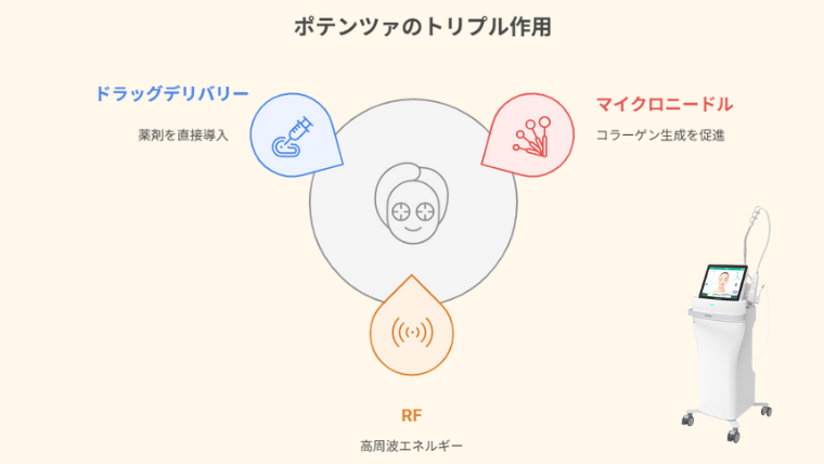 ポテンツァのトリプル作用、ドラッグデリバリー、RF、マイクロニードル