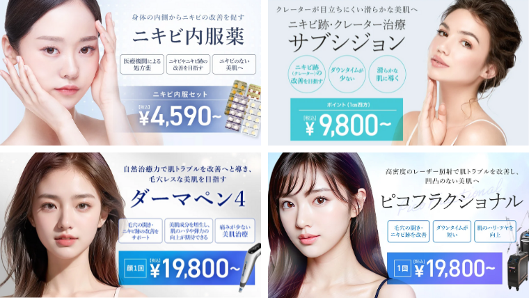 TCBニキビ・ニキビ跡・クレーター治療メニュー一覧