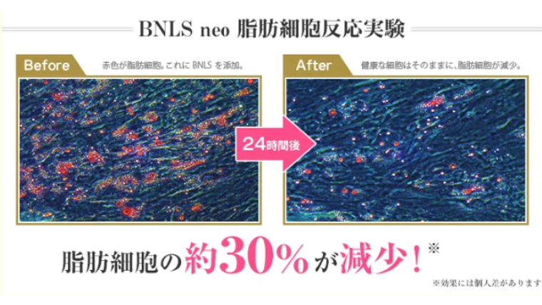 TCB脂肪溶解注射効果
