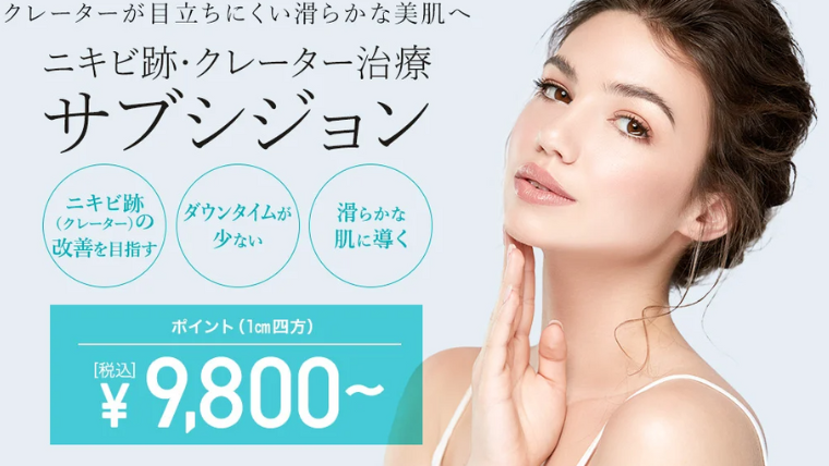 TCBサブシジョン