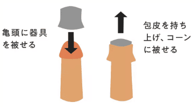 クランプ法イメージ2手順目