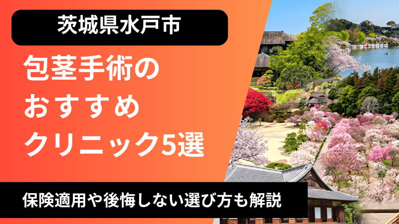 水戸のおすすめ包茎手術クリニック5選 | 治療費や保険適用についても解説
