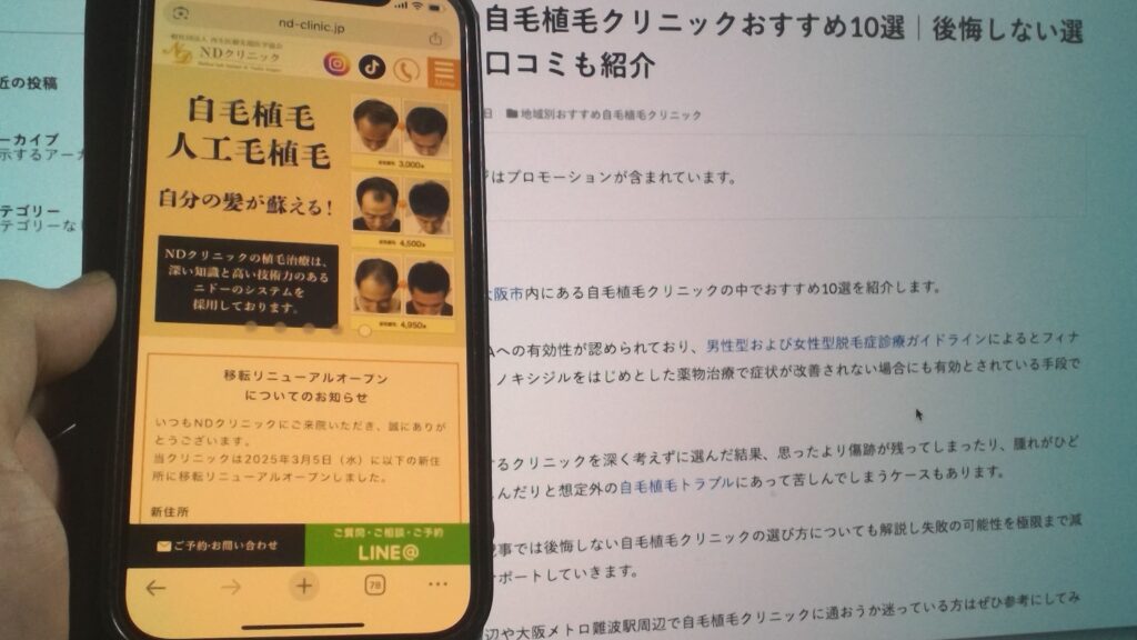 NDクリニック記事イメージ