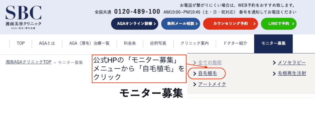 湘南AGAクリニックのモニター募集検索画面